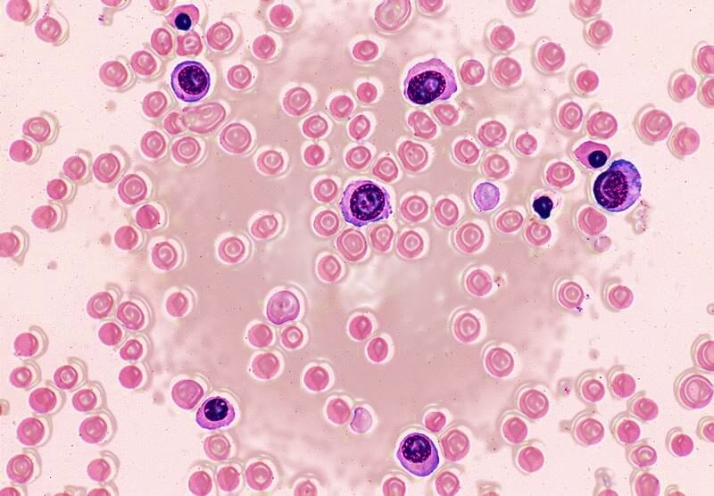 Фото: epomedicine.com